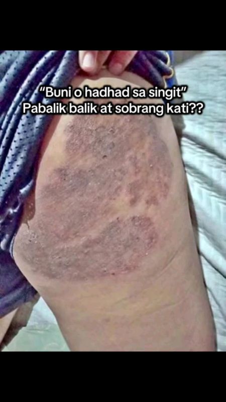 #KasoySoap #skinproblem #soapforskinproblem #masmurasashoppee #foryou #fyp #FreeCoinsInShopeeVideo #highlights #fypage #commsxtra #orderna #ctto #fyyp
